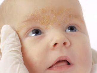 ¿Mi bebé puede sufrir problemas a la piel?